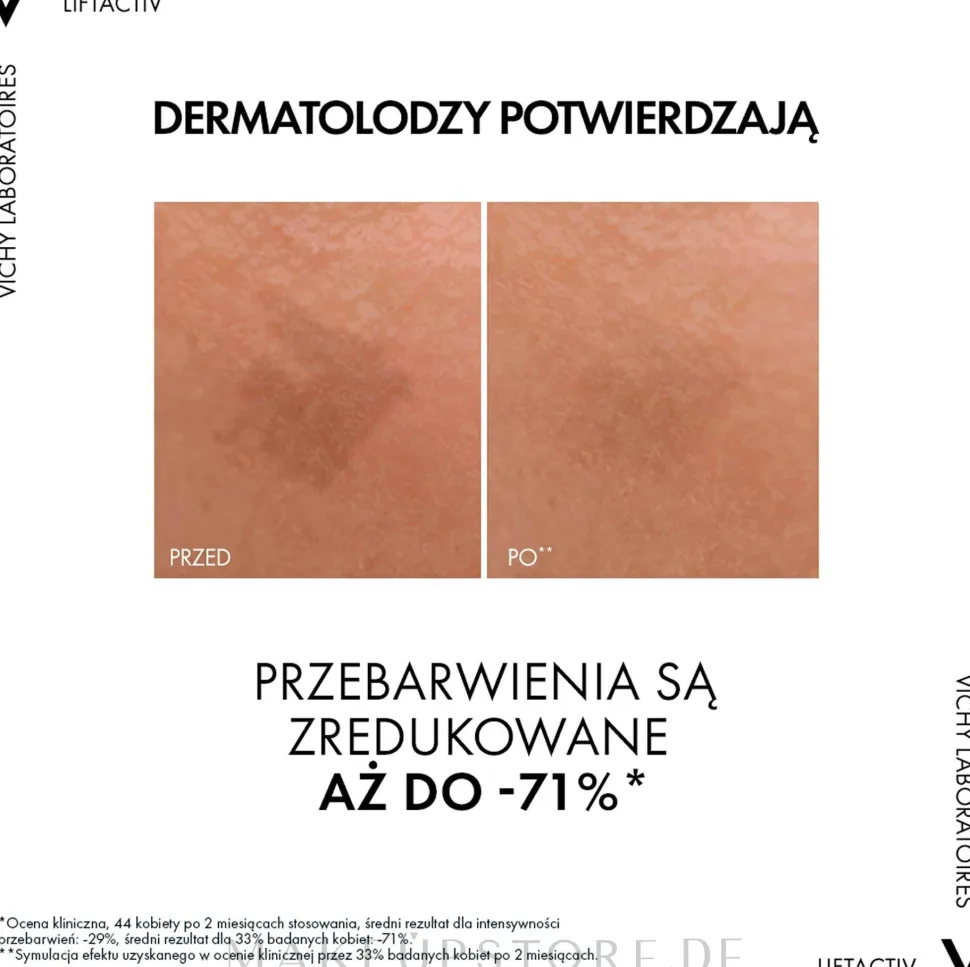 Anti-Aging Gesichtsserum gegen Pigmentflecken und Falten mit Niacinamid und Glykolsäure