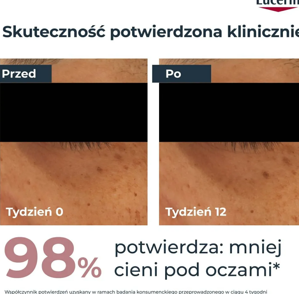Anti-Pigment-Creme für die Haut um die Augen