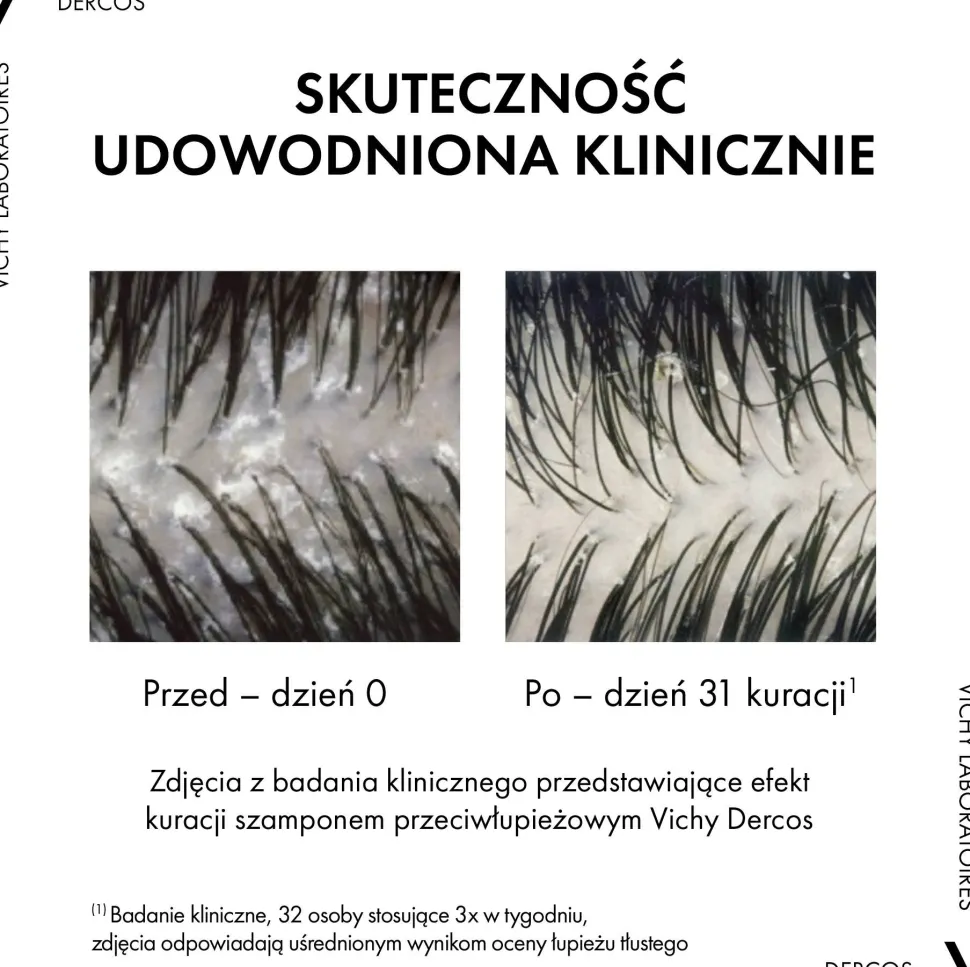Anti-Schuppen Pflegeshampoo für trockenes Haar