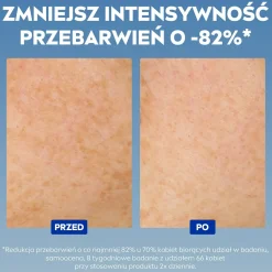 Gesichtsserum gegen Pigmentflecken