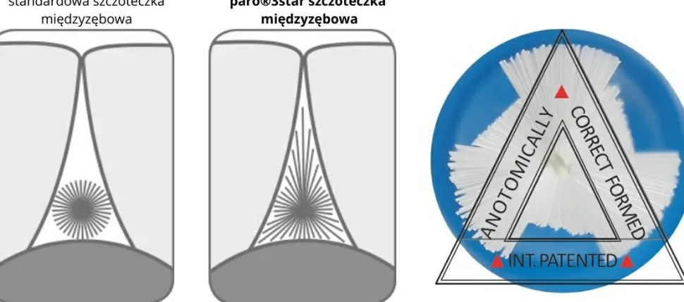 Interdentalzahnbürste 2.6 mm
