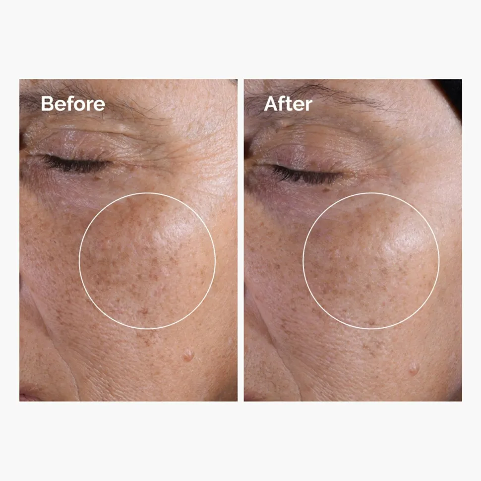 The Ordinary Glycolic Acid 7% Exfoliating Toner