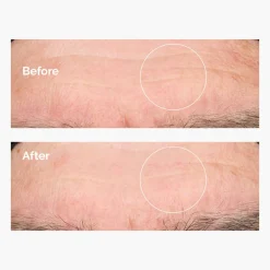 The Ordinary Hyaluronic Acid 2%